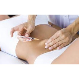 Sesión tatamiento Reducción Flacidez de Abdomen