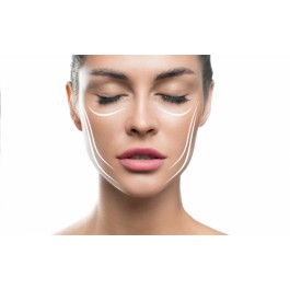 Sesión tratamiento Bioplastia, Lifting líquido