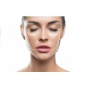Sesión tratamiento Bioplastia, Lifting líquido