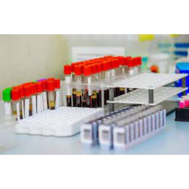 Test Ácidos Grasos en suero (AG36)