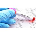 Test Estudio de 20 IgE- alergias alimentarias