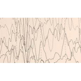 Test FG Neuro Epilepsia