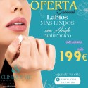 SESIÓN TRATAMIENTO AUMENTO DE LABIOS ÁCIDO HIALURÓNICO