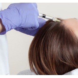 Sesión Mesoterapia Capilar