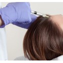 Sesión Mesoterapia Capilar